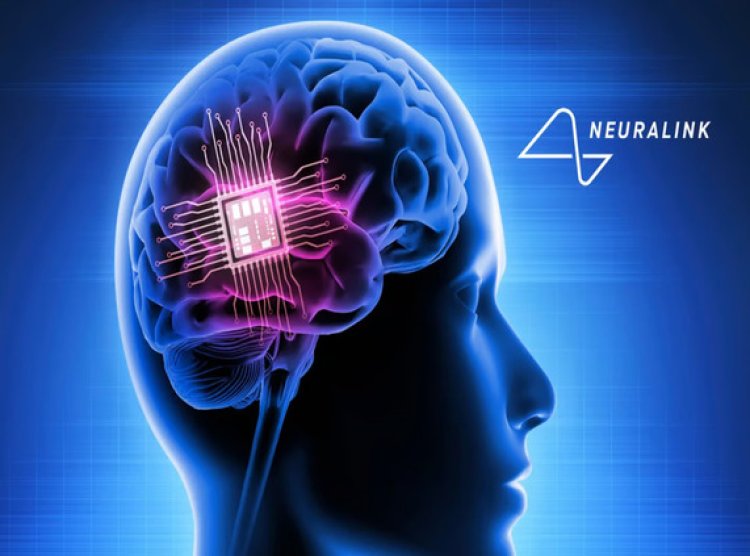 Neuralink Faces Setback with First Human Implant