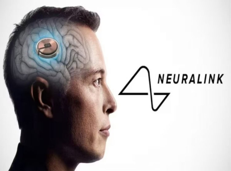 Neuralink Achieves Success with Second Human Implant in New Trial